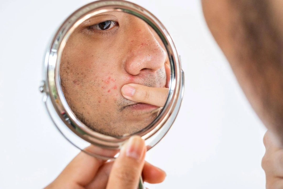 How is dull and uneven skin diagnosed.