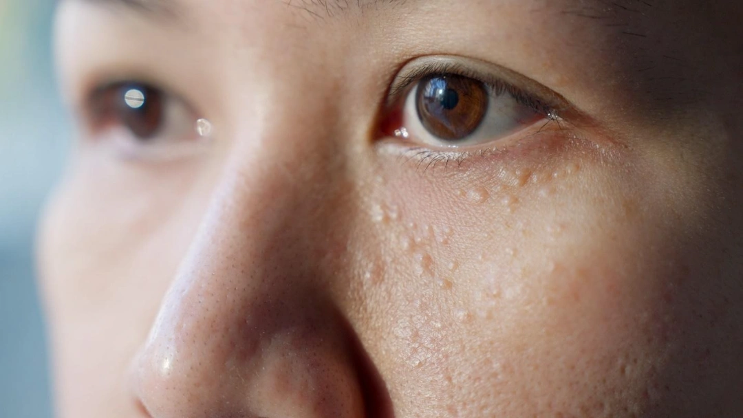 milia seeds Singapore.