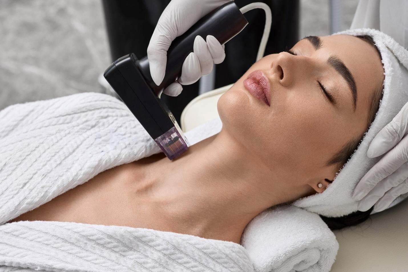 RF skin tightening post-treatment recovery and skin response.