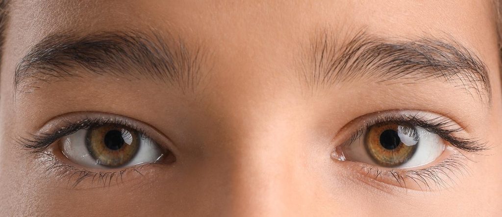 combination treatment for mixed dark eye circles in Singapore.