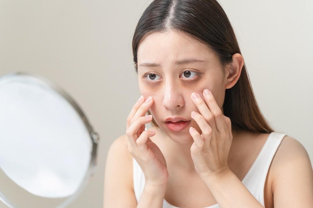 dark eye circle treatment for pigmentation.