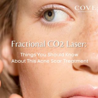 Image 19: Heard a lot about CO2? 🤔 Here’s what you need to know about this laser treatment! It’s super effective for tackling acne scars and rejuvenating your skin. Not sure if it’s the right fit for you? Book a consultation with us! ☎️ 8082 0998 (Call/Whatsapp) 📍Wheelock Place #04-07 #l#lasertreatmentclinic #laserspecialist #aestheticclinicsg #co2fractionallasertreatment #acnescars #acnescarstreatment #CO2laserskinresurfacing