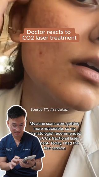 Image 18: Check out what Dr. Gabriel has to say about how CO2 laser can help reduce deep acne scars! 🌟 It works by boosting collagen and resurfacing your skin for some amazing results. Thinking about giving it a go? Book a consultation with us today! ☎️ 8082 0998 (Call/Whatsapp) 📍Wheelock Place #04-07 #lasertreatment #laserspecialist #co2fractionallasertreatment #acnescars #acnescarringtreatment #acnescarringtreatment #lasertreatmentsg